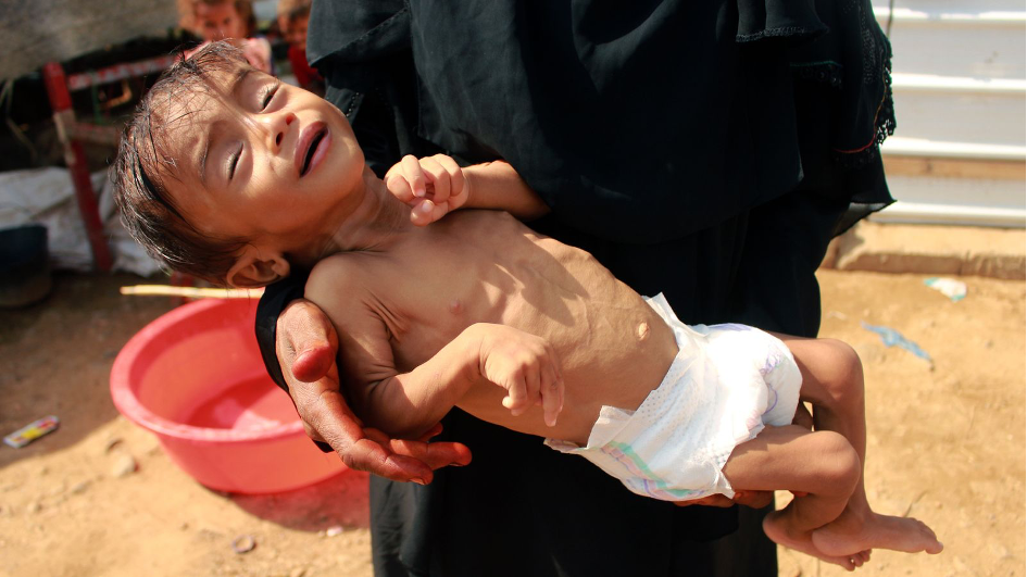 JEMEN «Den største humanitære katastrofe i vår til.» (FN)