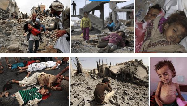 Jemen- Vestlige makter og Saudi-Arabia dreper bredt i krigen 2